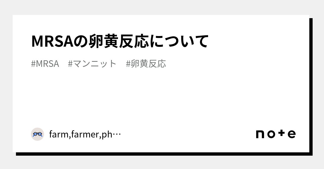 販売 マン ニット 分解能