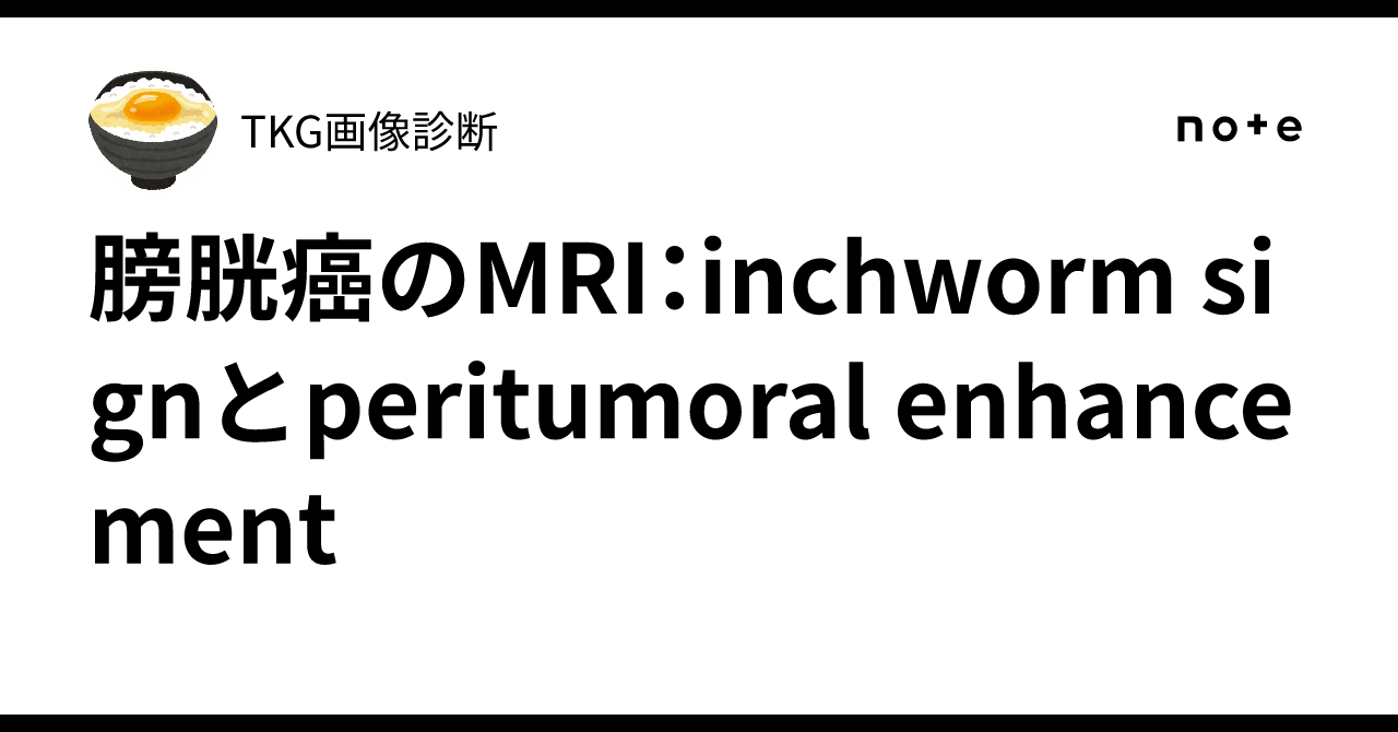 膀胱癌のMRI：inchworm signとperitumoral enhancement｜TKG画像診断