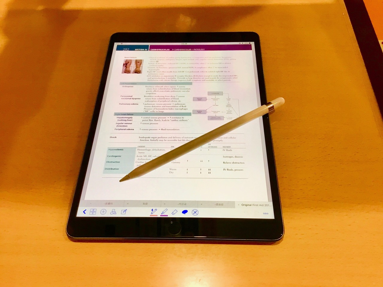 医師国家試験の勉強をipadメインで行う方法論 Digi でじすたねっと Note