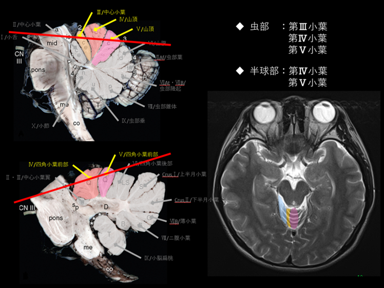 デンマークでは約1万個の脳が地下に保管されている。そして真実は？