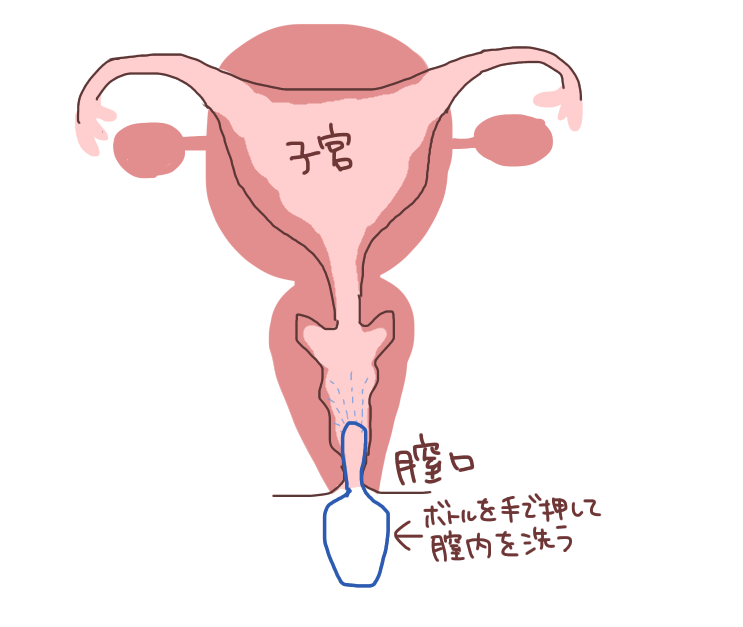 生理とうまく付き合っていく パートナーにも知ってほしいこと カップルがセックスを話す ぬー しゅー Note