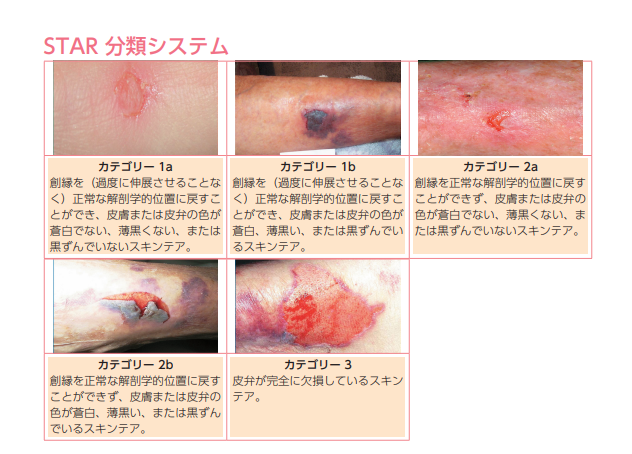 そもそも、「スキン‐テア」とは何か？｜P.P.B.N｜note