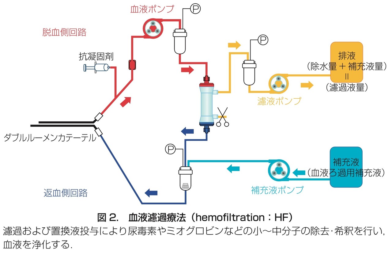 透析の基礎知識を分かる範囲でまとめてみる｜薬備（ヤクビ）〜保険薬局薬剤師のアカデミック備忘録〜鎌田貴志｜note