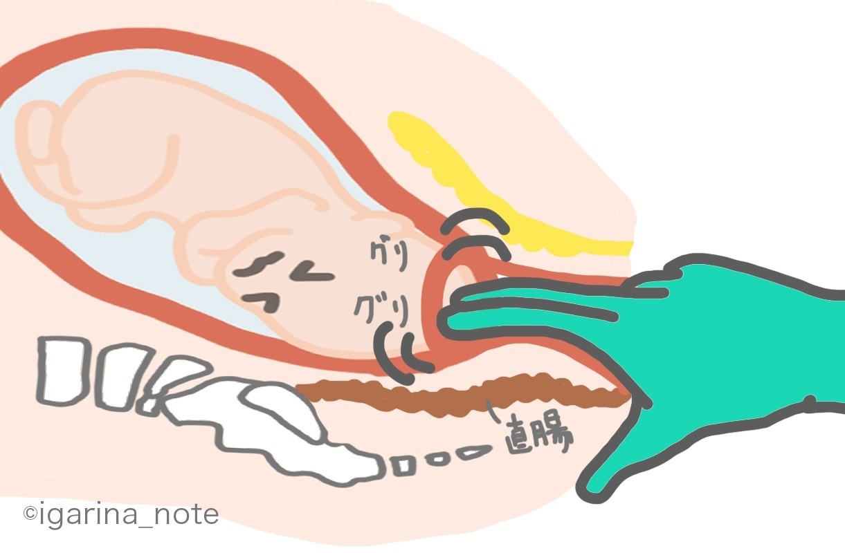 出産の時 う こは我慢できるのか問題 いがりな Note