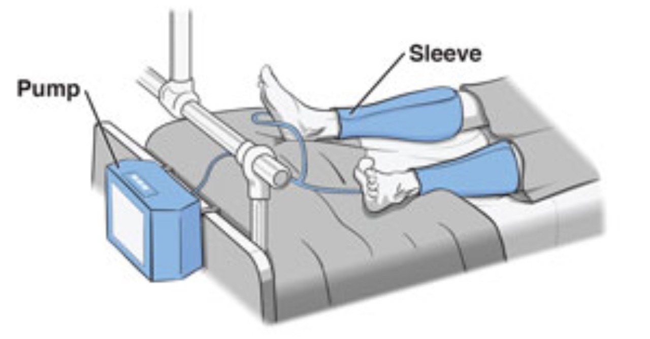 ＜文献紹介 第3弾：ICUでのDVT予防にフットポンプは必要なのか？！＞｜侑｜note
