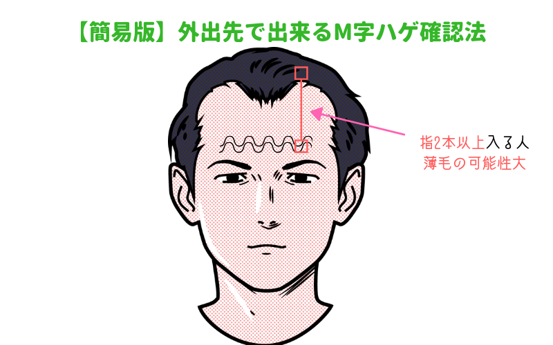 壮大 前髪 はげ 基準 ngantuoisoneo5