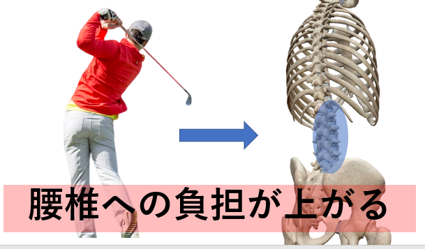 腰痛につながるフィニッシュの3つの特徴とは 宮田 洋佑 柔道整復師 Jspo At Note