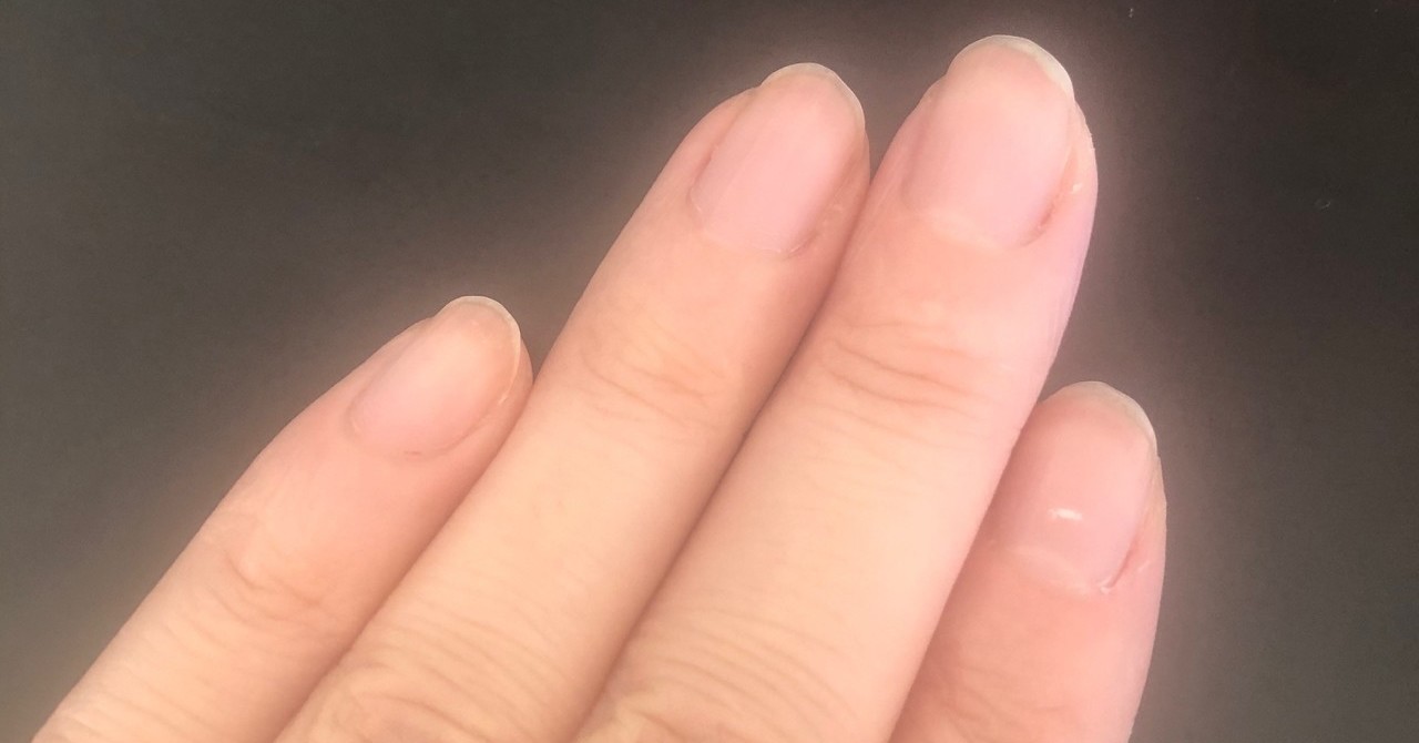 爪 白い 点 幸運 親指