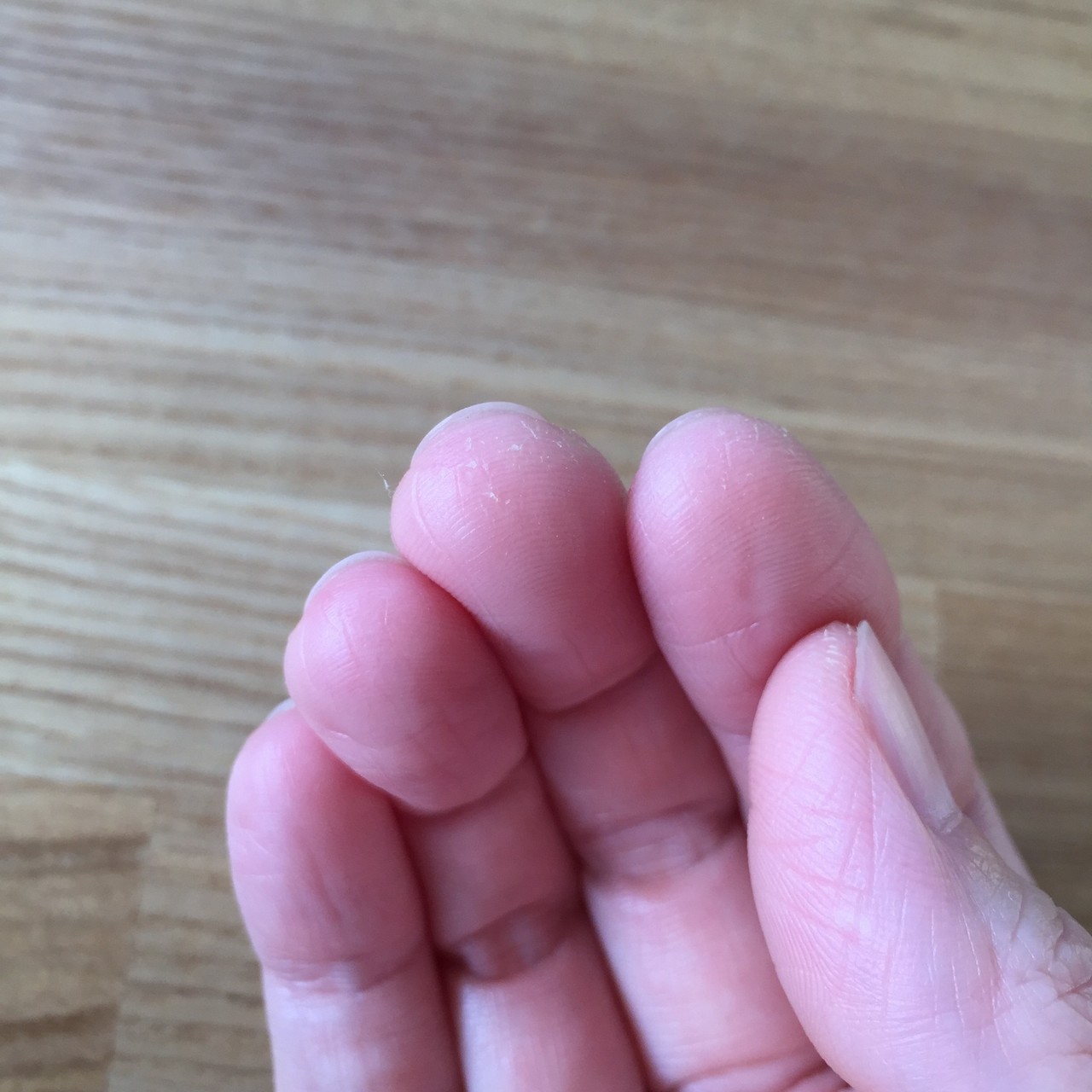 指先のガサガサをなんとかしたい アユミ 絵描き Note