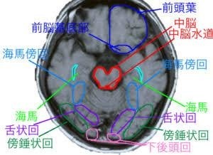 地理的障害のリハビリテーション 症例報告 サンダー 謙虚 バード Note