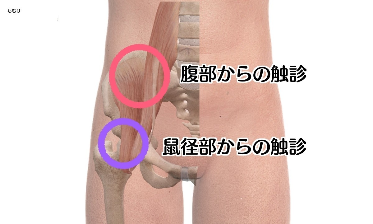 臨床で使える腸腰筋 腸骨筋 大腰筋 の知識 もぬけ 国試対策 鍼 柔 あ Note