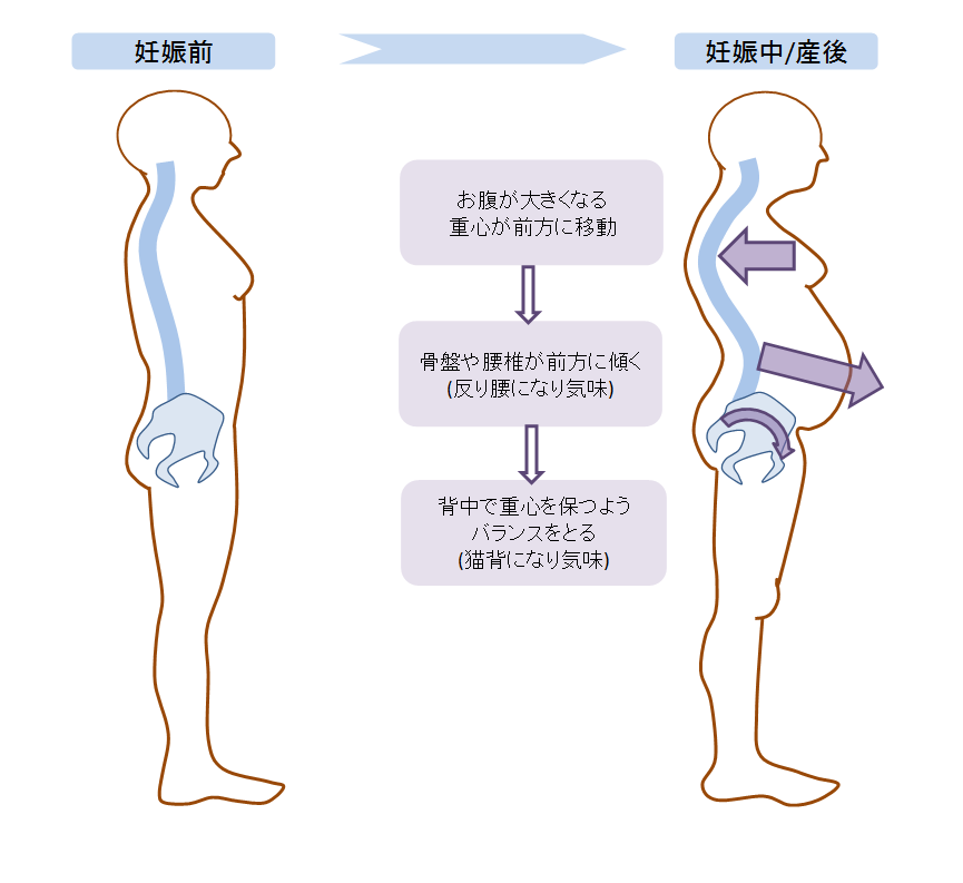 妊娠中の骨盤矯正はアリか無しか 松倉 卓也 Note