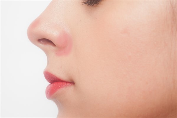 小鼻の赤みの原因とスキンケアでの改善方法 上手な隠し方 まめ Note