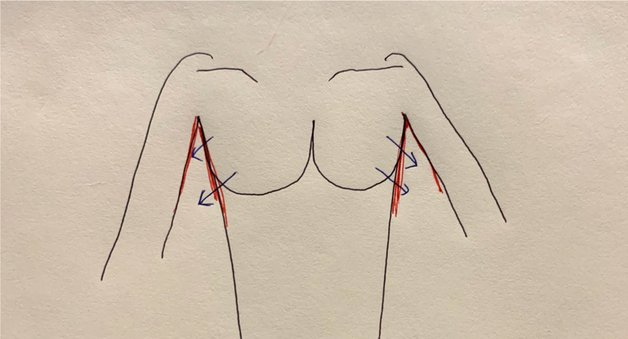 生まれつき はなれ乳 の人はいないです ってお話 根本三津葉 美バストコンサルタント