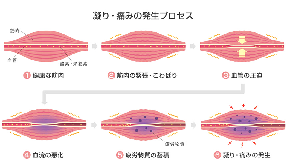 筋肉痛が和らぐって本当 筋トレとcbdの関係まとめ Cbd Cure Cbd Skincare Online Shop ﾟ Note