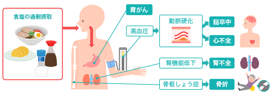 太る 塩分