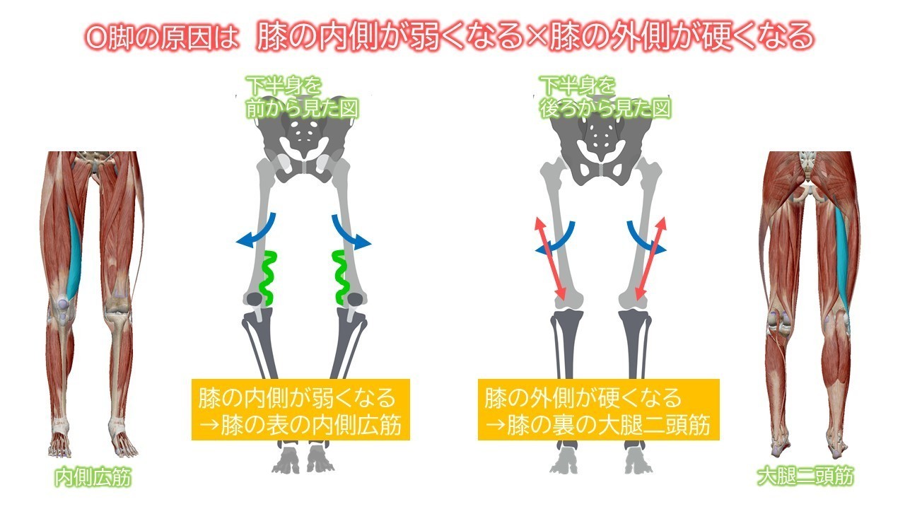 3つの部位からしっかり治す！О脚改善のススメ～膝上O脚ver～｜理学療法士キリツ（シセトレ）＠姿勢クリエイター｜note
