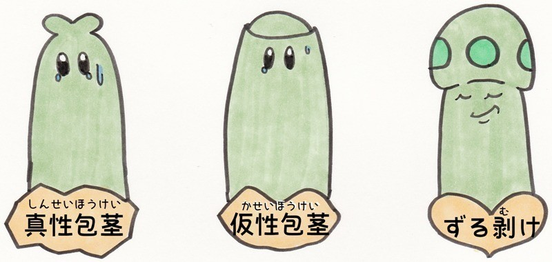 包茎はどうすればいいですか？