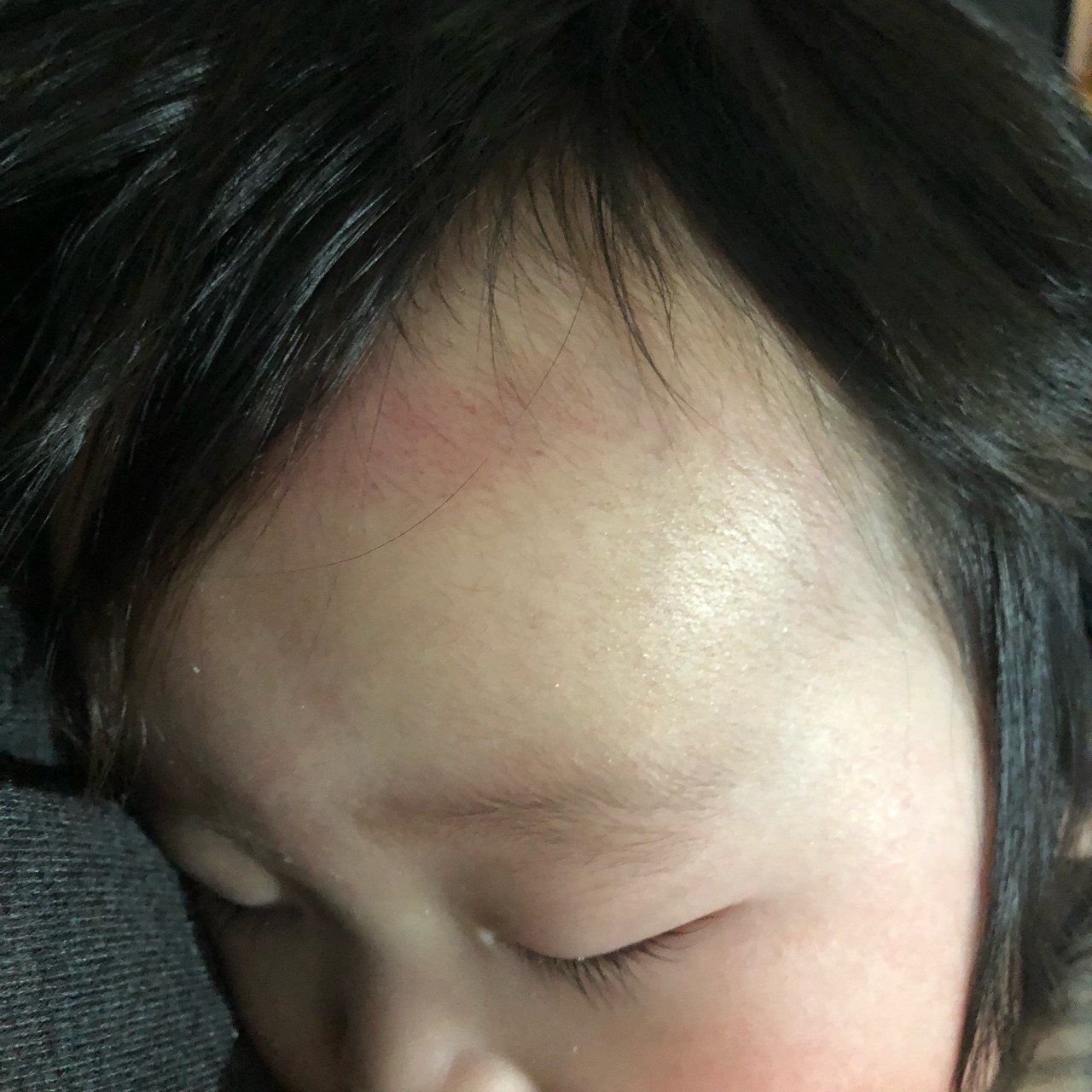 子供 おでこ たんこぶ